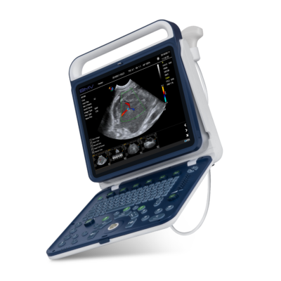 Echographe Doppler Couleur + 1 sonde micro convexe