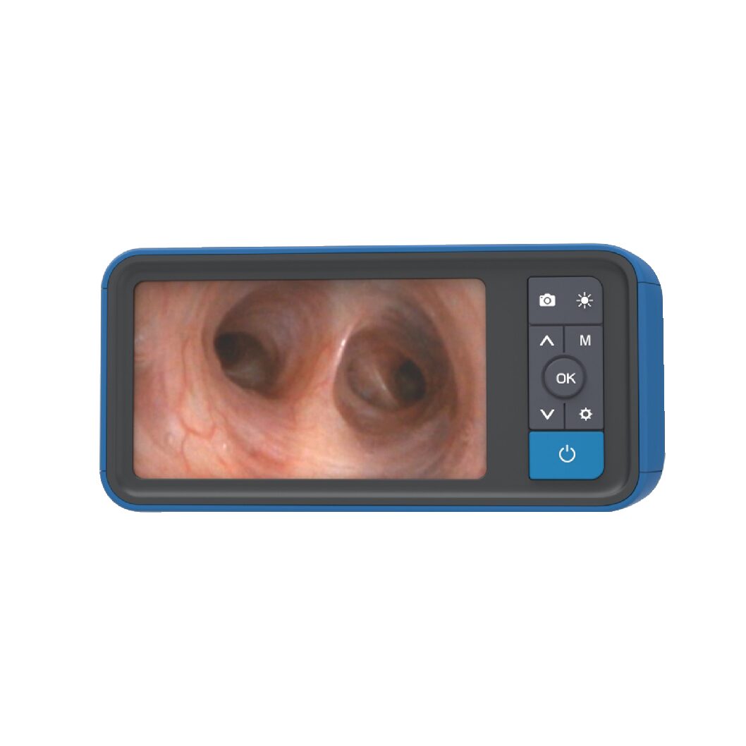 Station Vidéo - Écran pour endoscope 1 - 2 - 3 - 4