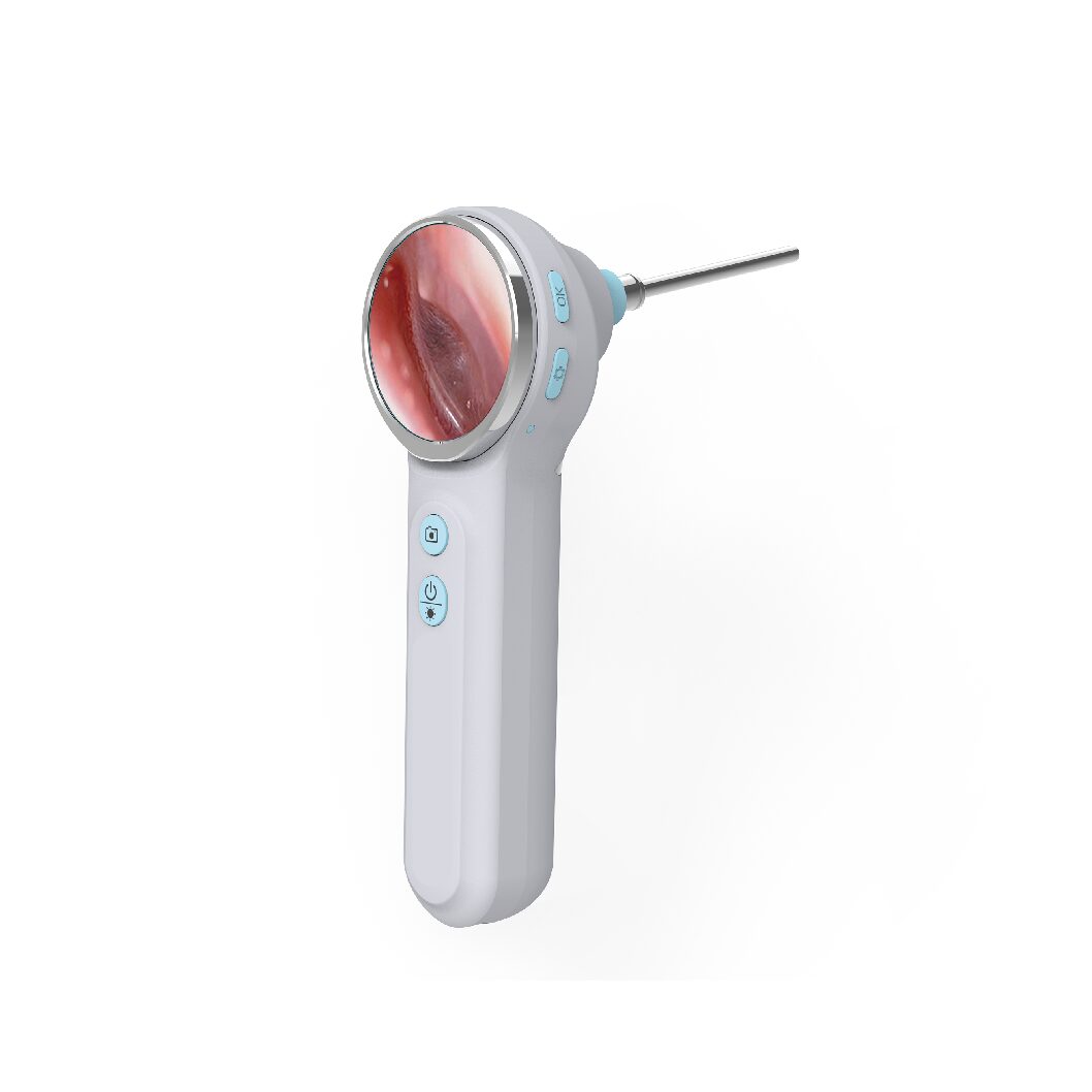 Otoscope Vidéo – Capture Photo/Vidéo