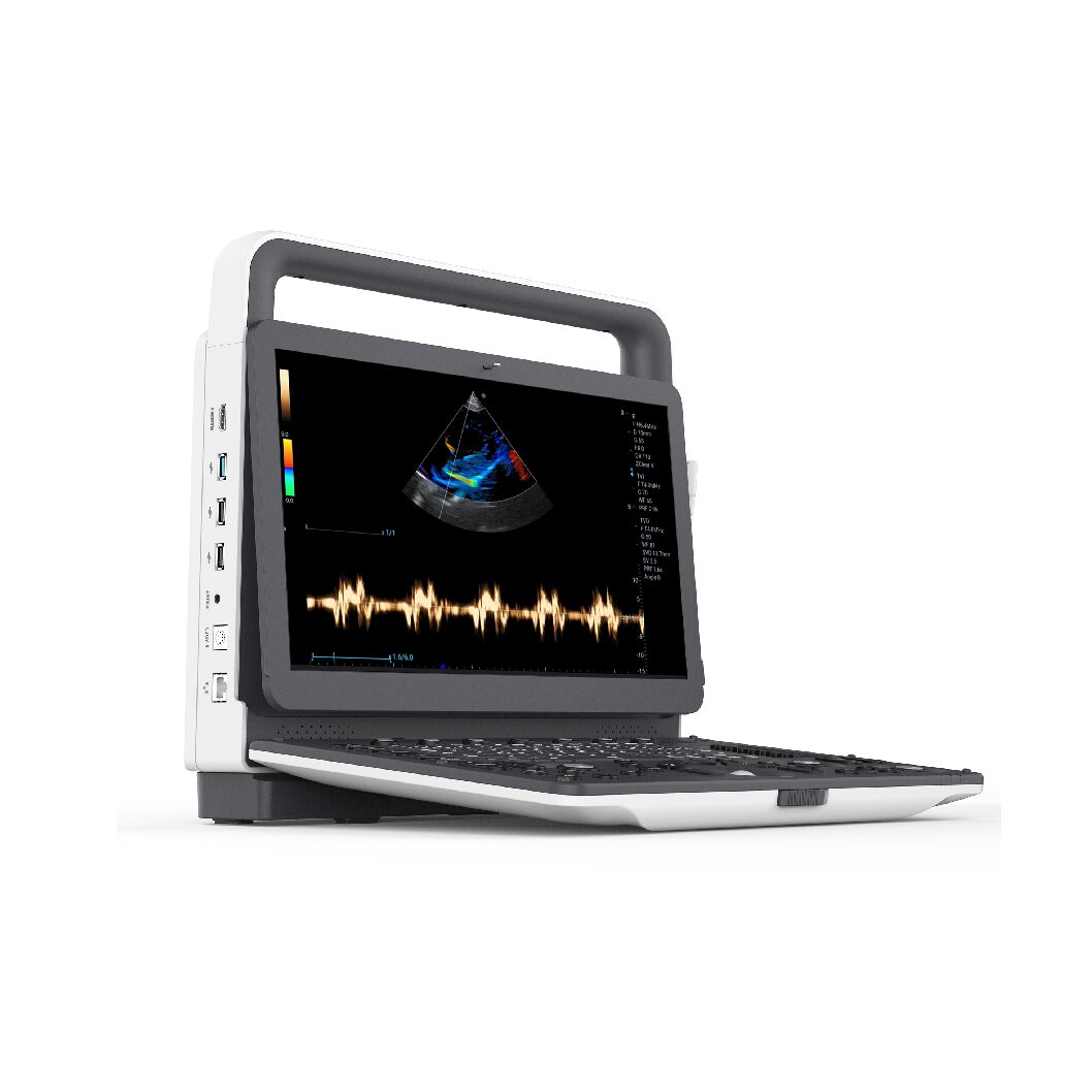Echographe VU3 Portable Haute Résolution – Doppler Couleur + 1 sonde micro convexe