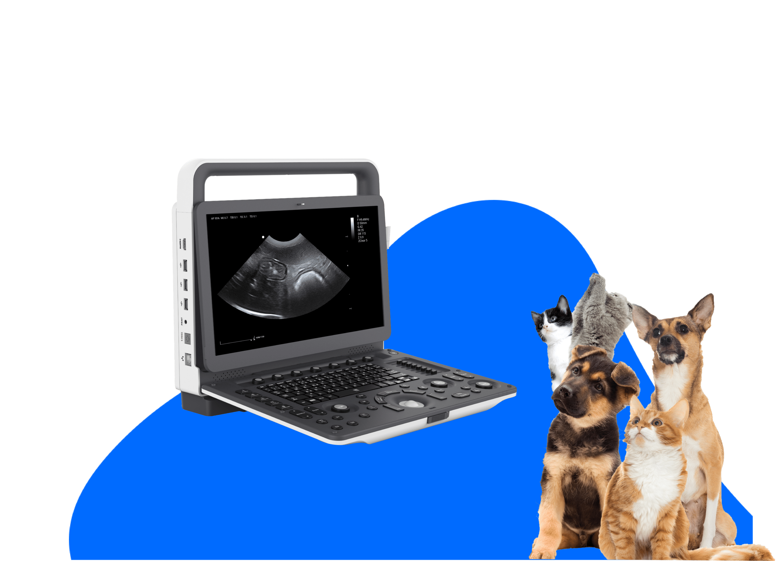 Echographe VU3 Portable Haute Résolution - Doppler Couleur