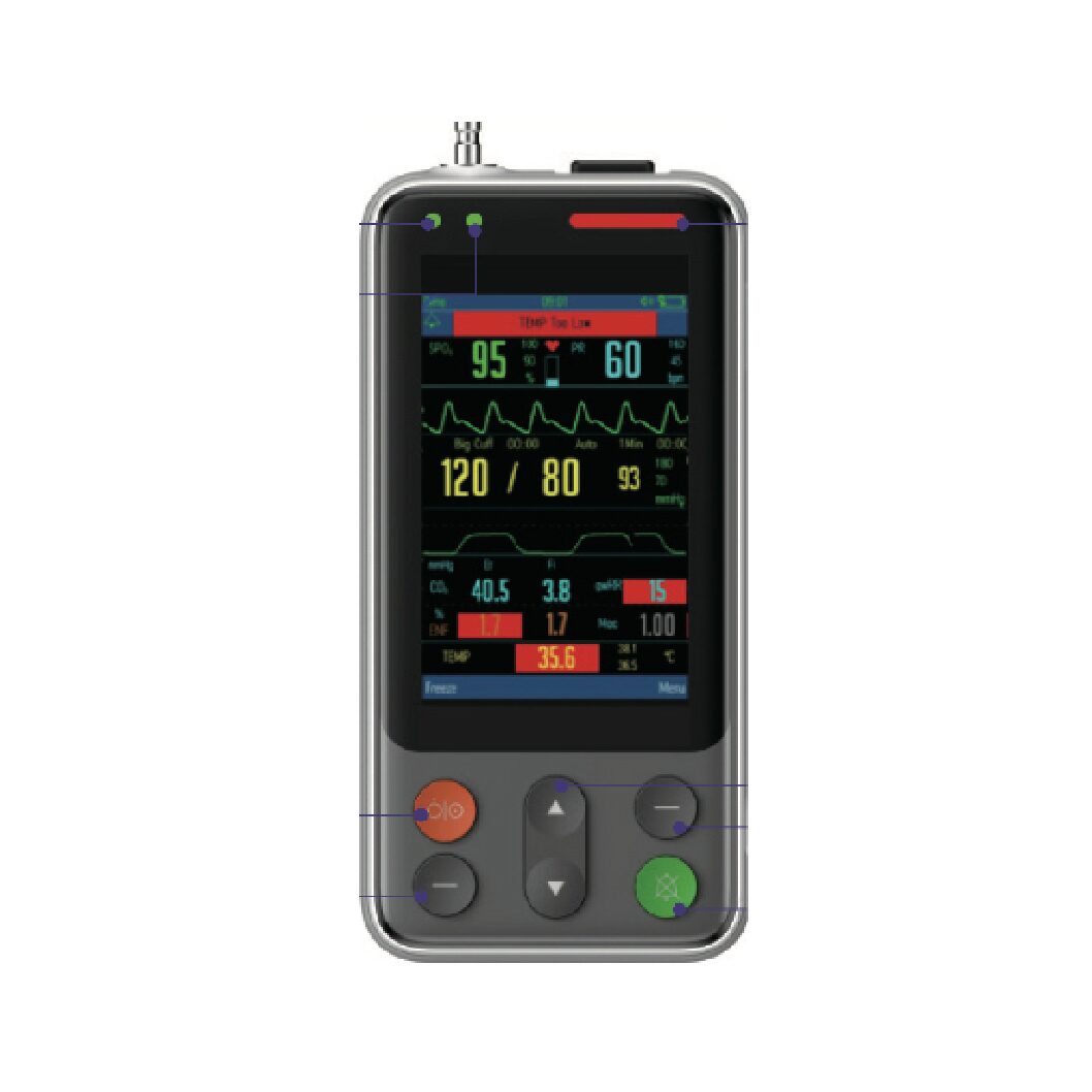 Moniteur d’anesthésie 4’’ Couleur