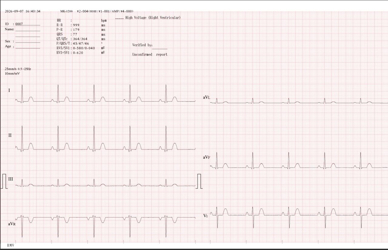 ECG 12 dérivations Ecran tactile 7" – Image 3